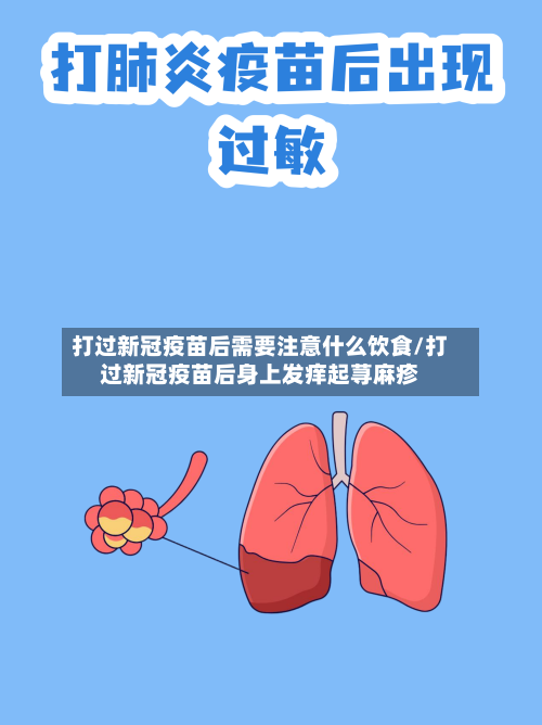 打过新冠疫苗后需要注意什么饮食/打过新冠疫苗后身上发痒起荨麻疹-第2张图片